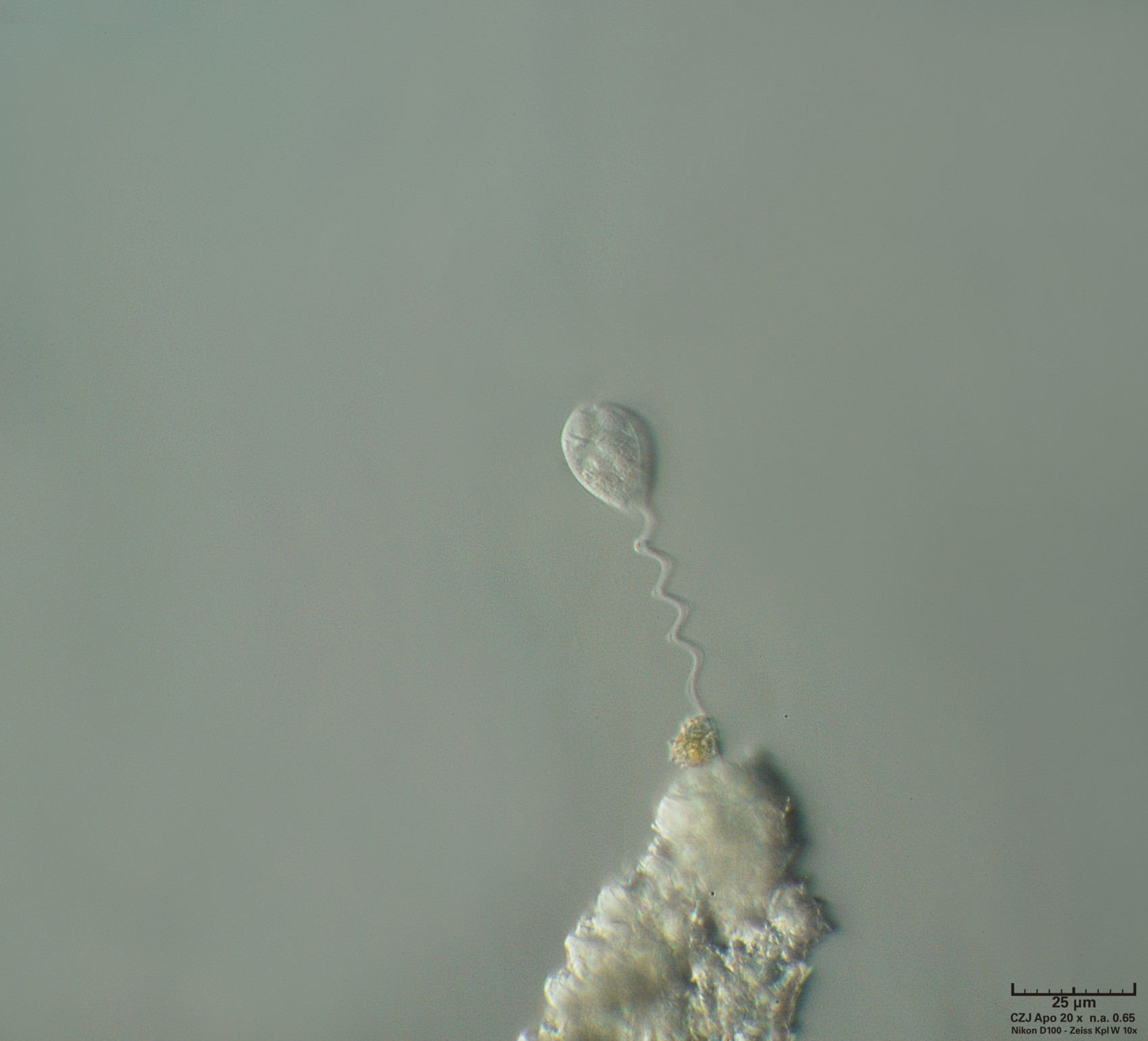 Vorticella